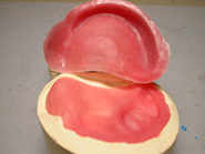 Otturatori palatali