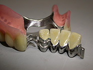 Scheletrati con fresature
