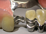 Scheletrati con fresature