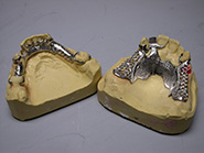 Scheletrati con ganci